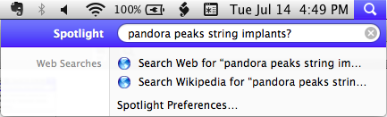 ./pandora peaks string implants - TRUE - Screen Shot 2015-07-14 at 4.49.07 PM.png